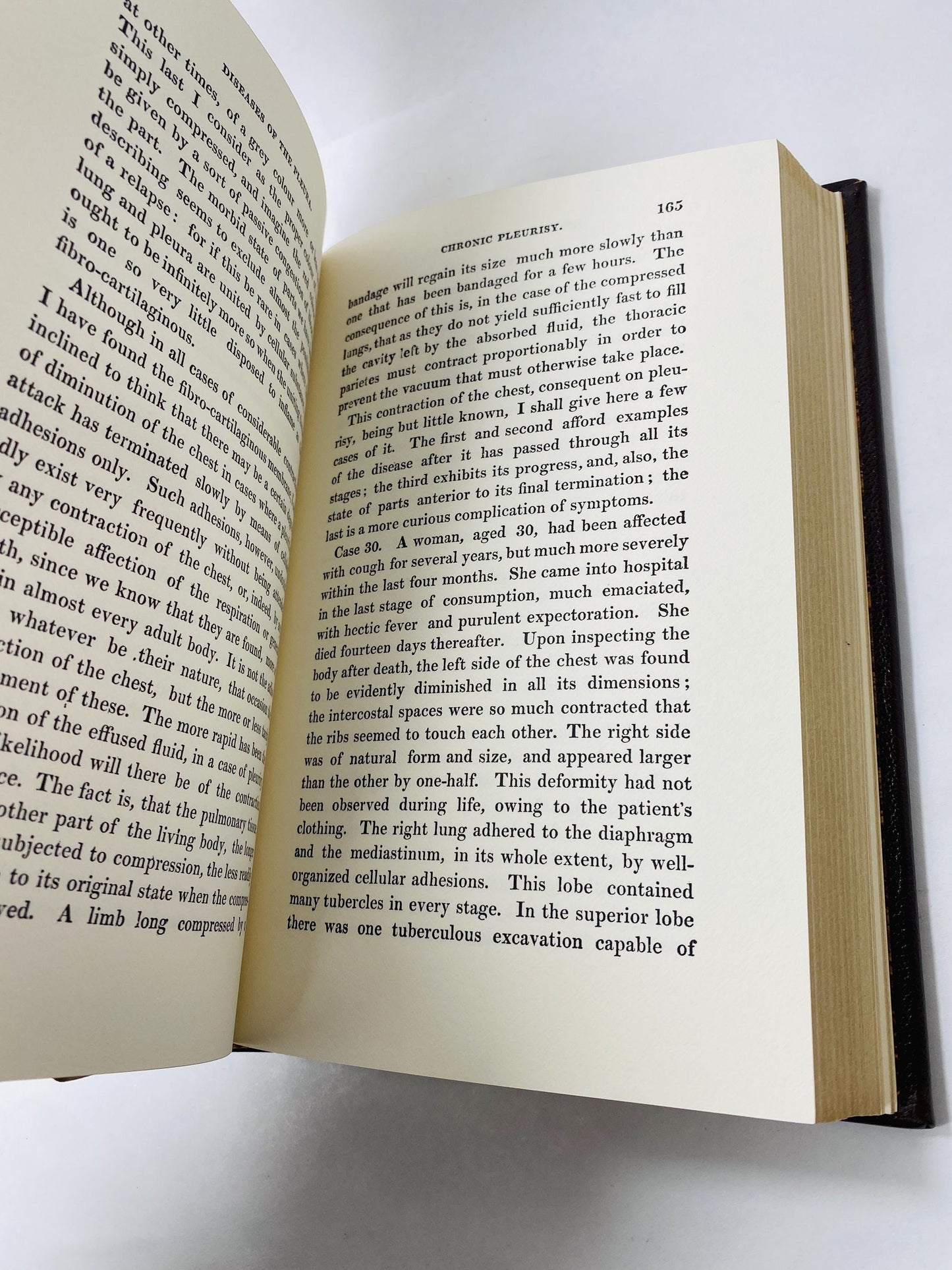 Diseases of the Chest Anatomy and Diagnosis vintage medical book by RTH Laennec GORGEOUS leather cover embossed gold Surgery Medicine Doctor