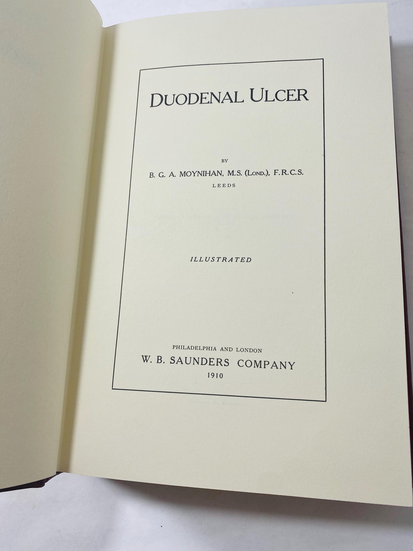 Duodenal Ulcer vintage medical book GORGEOUS rich leather embossed gold Doctor Moynihan Surgery Medicine Physician gift gastrointestinal